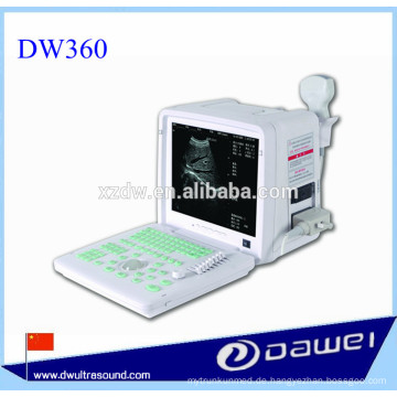 Ultraschallgerät für medizinische Geräte und tragbarer Ultraschallmonitor DW360